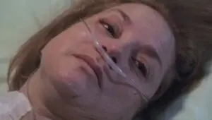 ER: 10×22